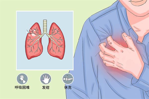 “肺都气炸了”可不是玩笑:气胸究竟是什么病?