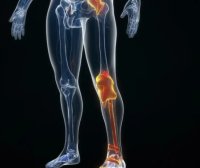 不穿秋裤会得老寒腿?这场“保暖执念”其实没你想的那么简单