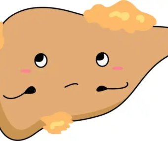 脂肪肝怎么吃?主食和肉类,哪个更该少吃?