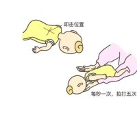 关键时刻能救命（2）：异物卡喉、骨折、手指切断、煤气中毒的正确处理方式